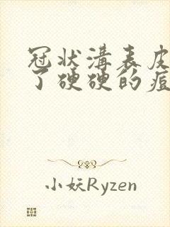 冠状沟表皮下长了硬硬的痘