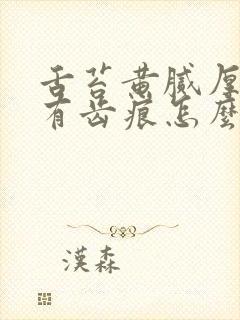 舌苔黄腻厚边沿有齿痕怎么回事