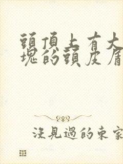 头顶上有大块大块的头皮屑是怎么回事