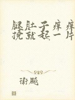 腿肚子痒痒,一挠就起一片疙瘩封面