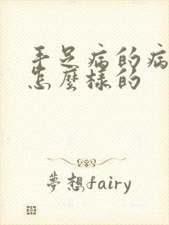 手足病的病症是怎么样的