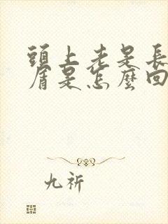 头上老是长头皮屑是怎么回事怎么治