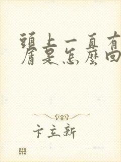 头上一直有头皮屑是怎么回事封面