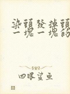 染头发掉头皮屑一块一块的怎么回事