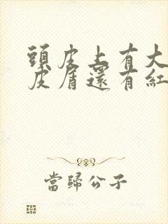 头皮上有大块头皮屑还有红疙瘩