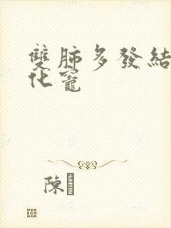 双肺多发结节钙化灶