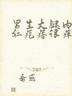 男生大腿内侧长红疙瘩很痒用什么药