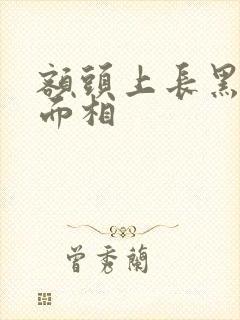 额头上长黑痣的面相