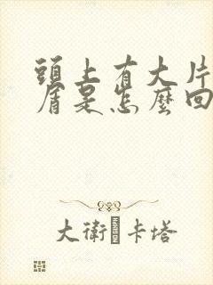 头上有大片头皮屑是怎么回事