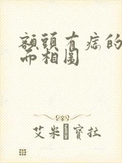 额头有痣的女人面相图