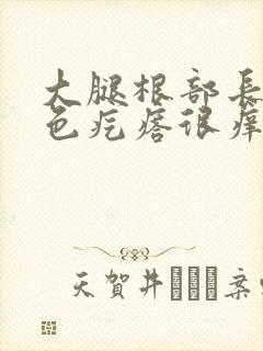 大腿根部长了红色疙瘩很痒