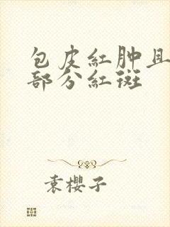 包皮红肿且龟头部分红斑