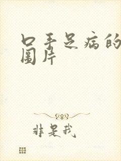 口手足病的症状图片