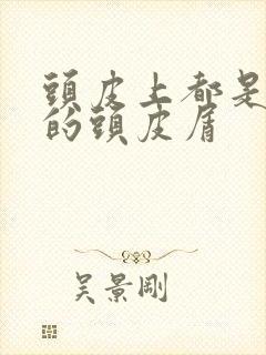 头皮上都是大块的头皮屑