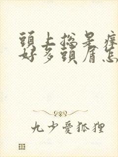 头上总是痒还有好多头屑怎么办啊封面