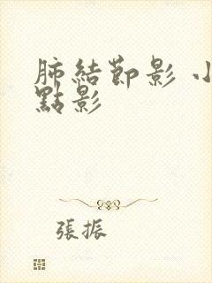 肺结节影 小斑点影