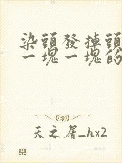 染头发掉头皮屑一块一块的怎么回事