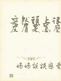 突然头上很多头皮屑是怎么回事