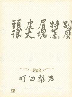 头皮屑特别多还很大块怎么回事