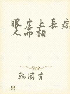 眼皮上长痣的女人面相封面