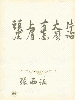 头上有大片的头皮屑怎么治疗