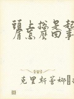 头上总是起头皮屑怎么回事