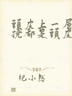 头皮上一层白一挠都是头皮屑