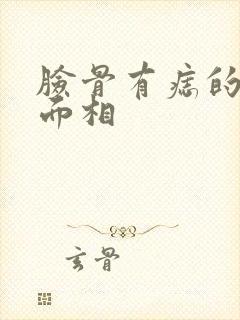 脸骨有痣的女人面相封面