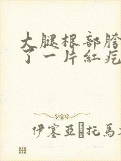 大腿根部胯部长了一片红疙瘩