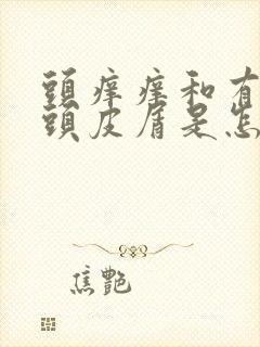 头痒痒和有很多头皮屑是怎么了