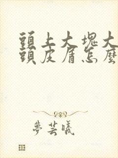 头上大块大块的头皮屑怎么回事