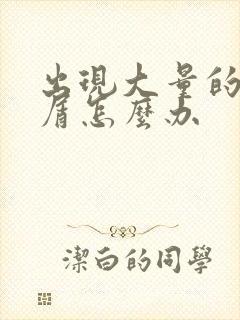 出现大量的头皮屑怎么办