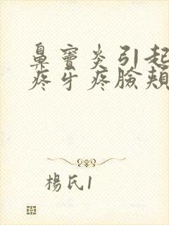 鼻窦炎引起的头疼牙疼脸颊疼封面