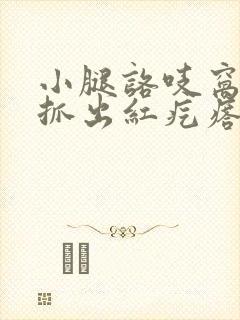 小腿咯吱窝痒 抓出红疙瘩封面