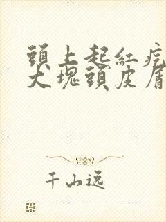 头上起红疙瘩,大块头皮屑是怎么回事