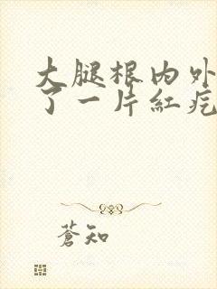 大腿根内外侧起了一片红疙瘩很痒