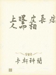 上眼皮长痣的女人面相封面