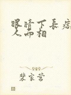 眼睛下长痣的男人面相