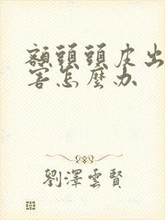 额头头皮出油厉害怎么办