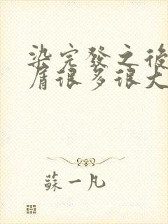 染完发之后头皮屑很多很大怎么办