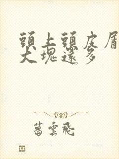 头上头皮屑特别大块还多封面