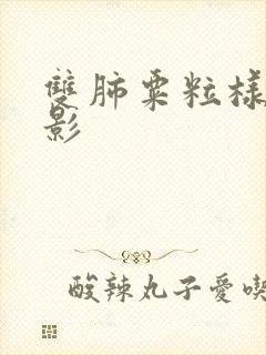 双肺粟粒样结节影