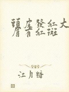 头皮发红大块头屑有红斑