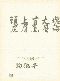 头上有大块的头皮屑怎么治疗