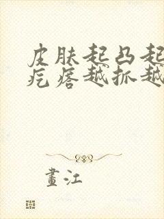 皮肤起凸起的红疙瘩越抓越痒