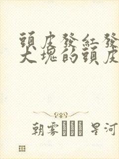 头皮发红发痒有大块的头皮屑是怎么回事