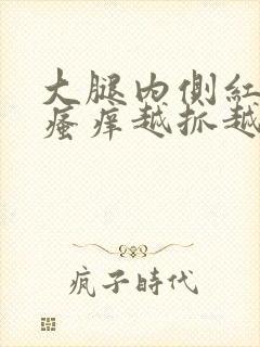 大腿内侧红疙瘩瘙痒越抓越痒封面