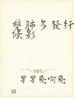 双肺多发纤维索条影封面