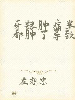 牙龈肿痛半边脸都肿了导致头也很痛