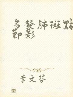 多发肺斑点 结节影